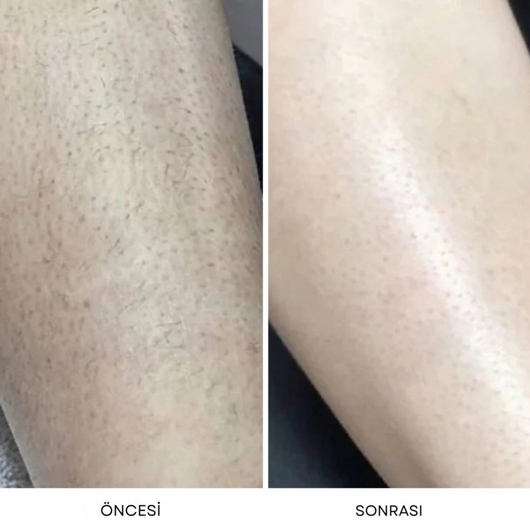 Dermave™ Trimmer 2.0