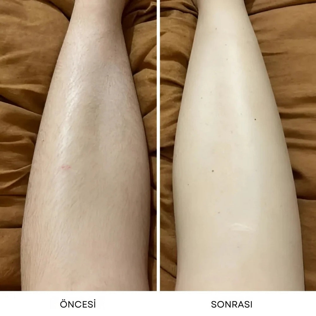 Dermave™ Trimmer 2.0