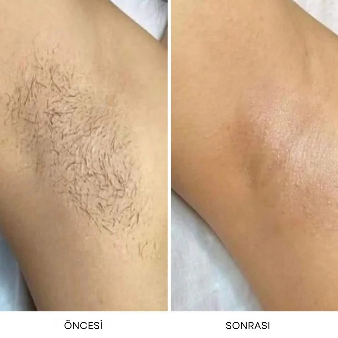 Dermave™ Trimmer 2.0