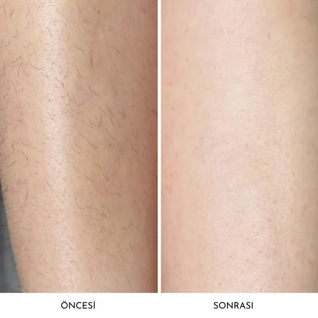 Dermave™ Trimmer 2.0