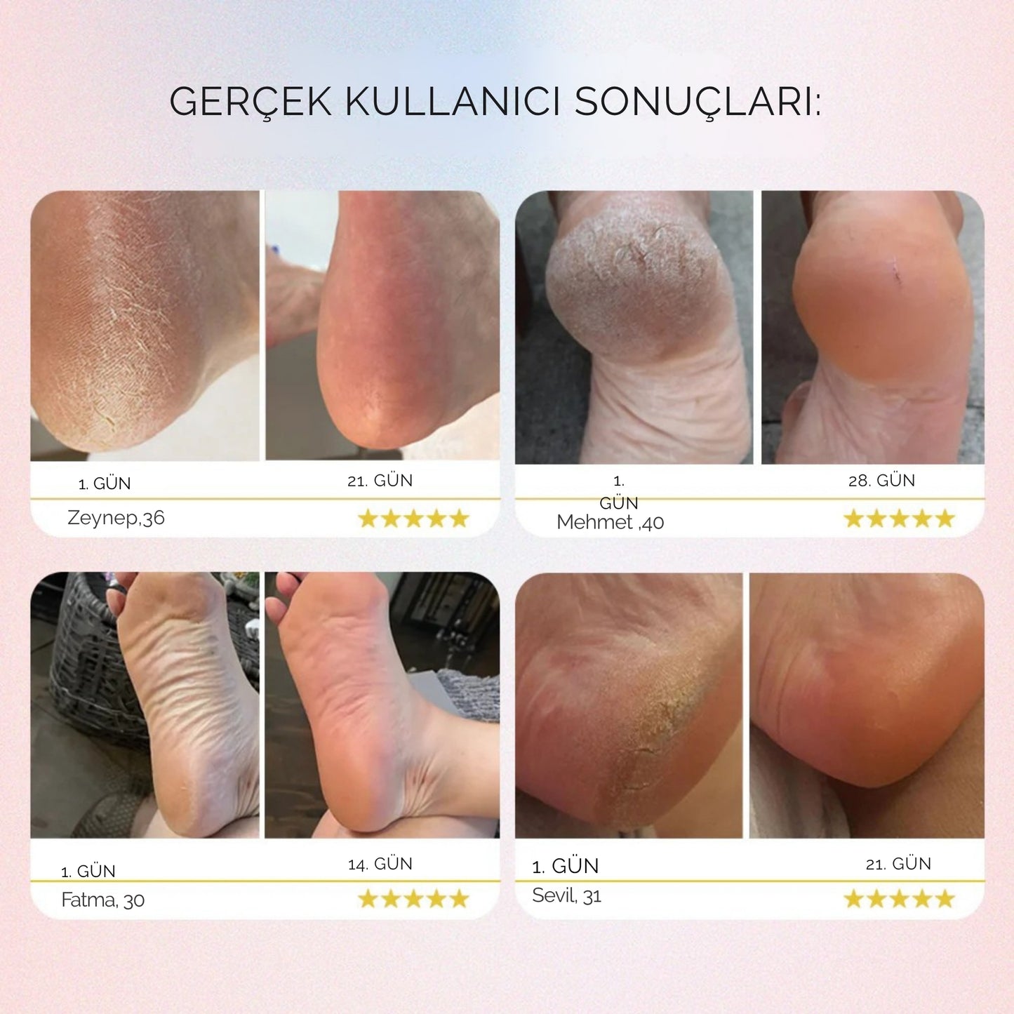 Dermave™ Elektrikli Ayak Nasır Sökücü